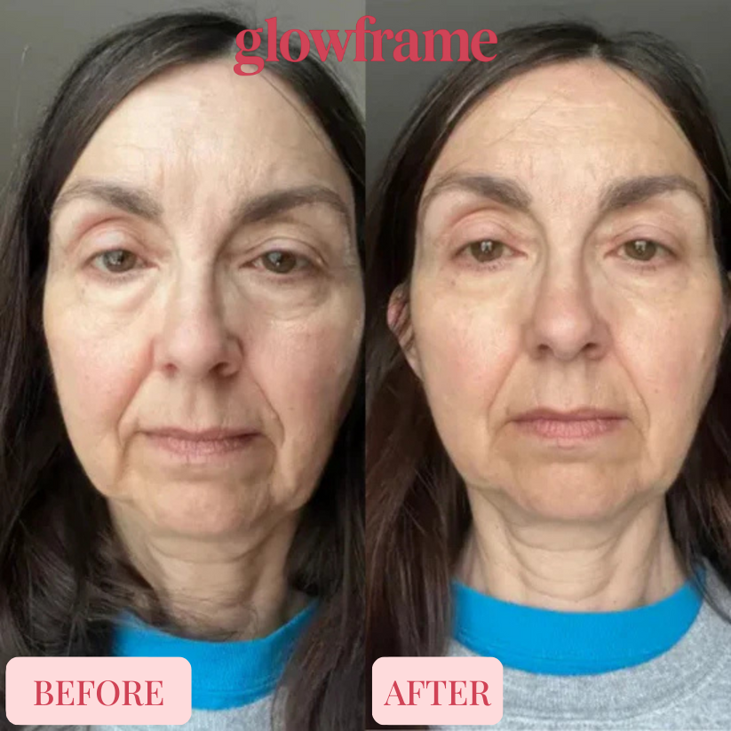 Glowframe Cemenrete Calcium Multi Balm