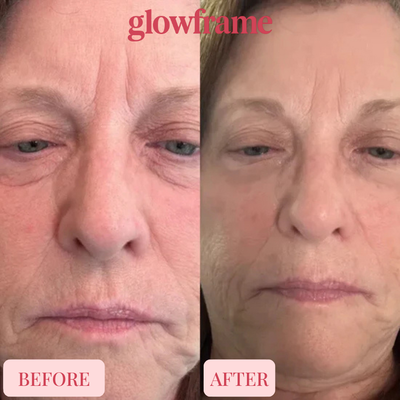 Glowframe Cemenrete Calcium Multi Balm